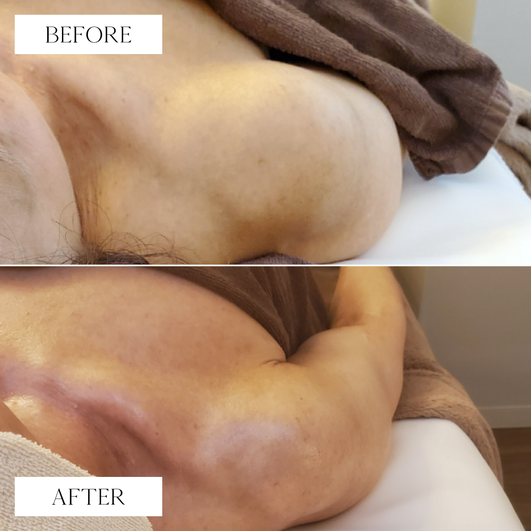 トリムハンド施術後写真3