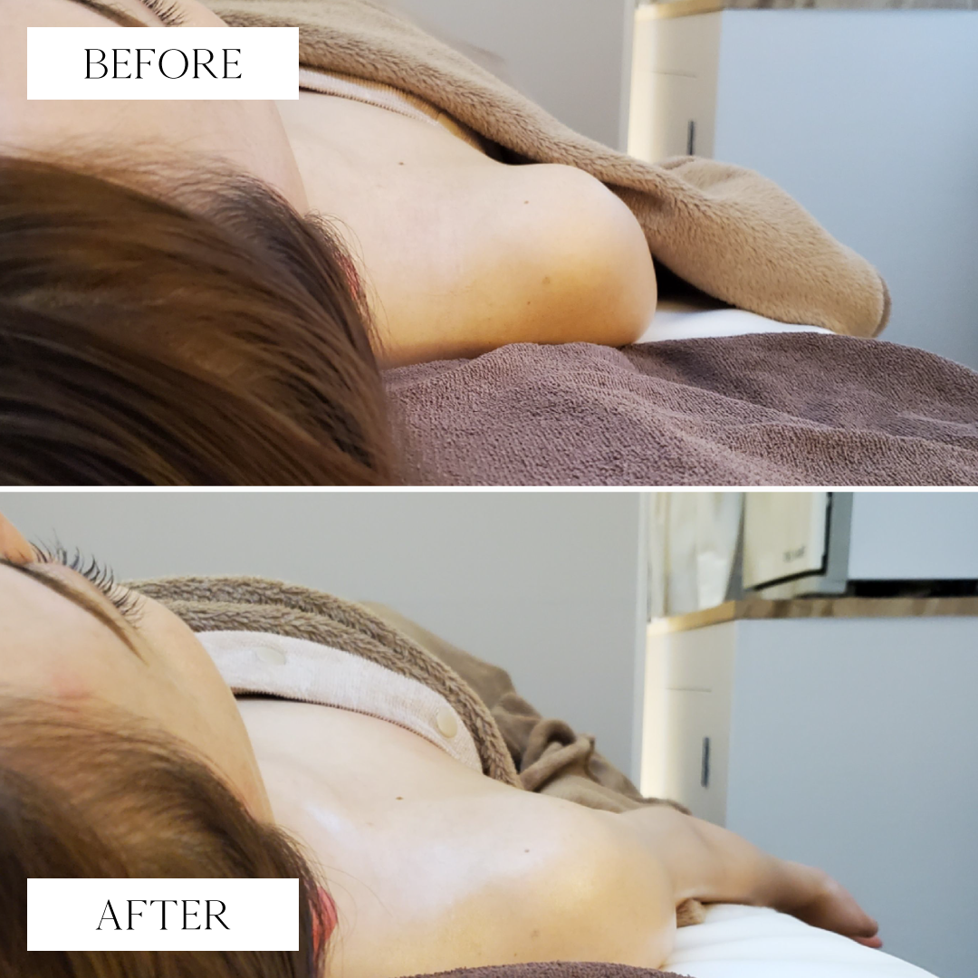 トリムハンド施術後写真5