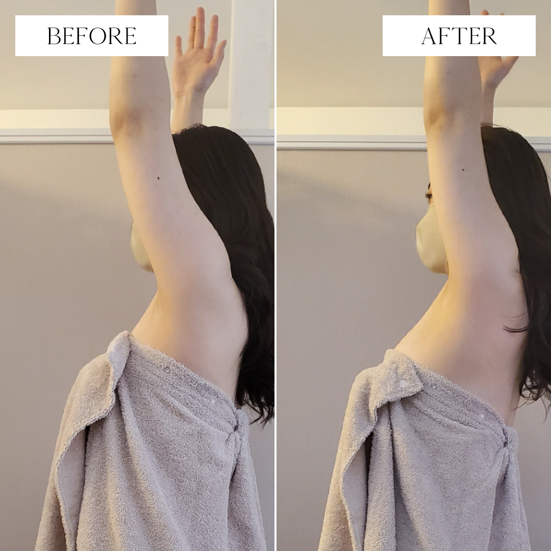 トリムハンド施術後写真2