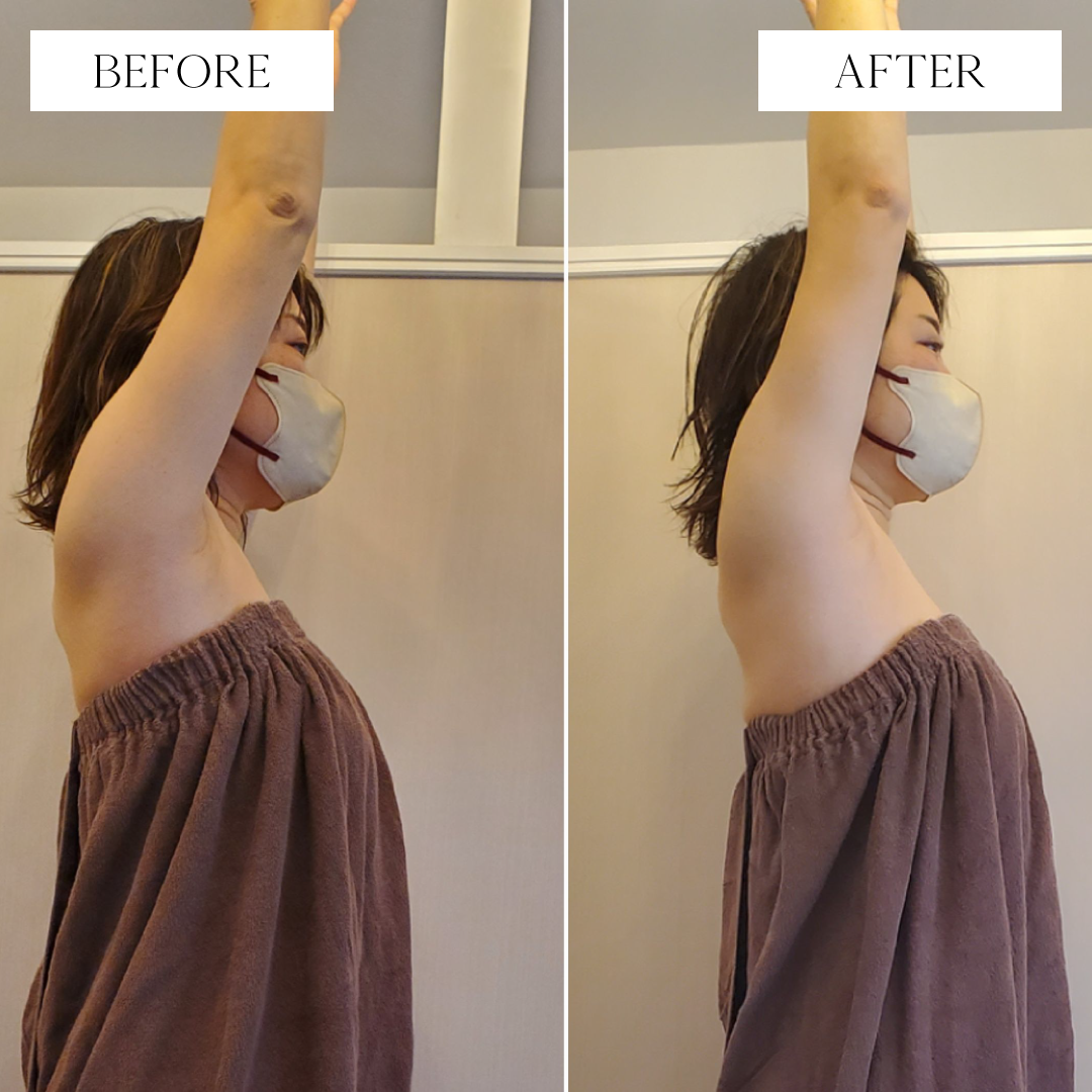 トリムハンド施術後写真4